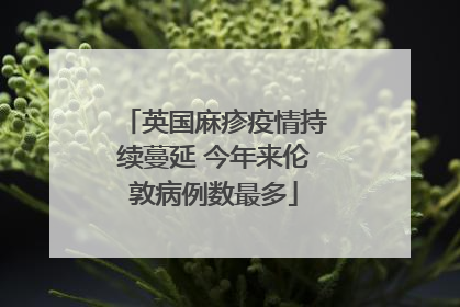 英国麻疹疫情持续蔓延 今年来伦敦病例数最多